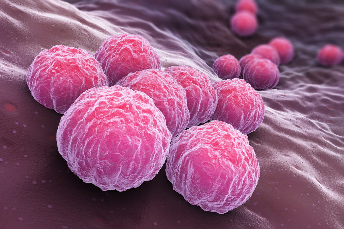 Symptomer på klamydia i halsen